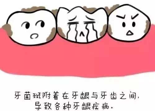 吃个饭牙齿内侧掉下来快东西 好恐怖