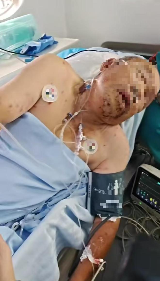 “悲剧还是发生了！”河南，75岁老人和老伴在城区河边景观桥散步，突遭虎头蜂围攻。