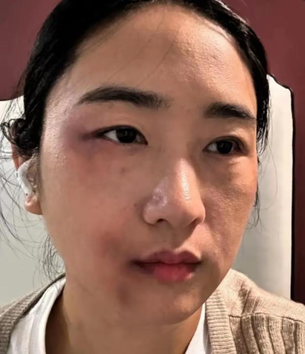 孕36周被丈夫一脚踹在腰上，这个准妈妈的选择，看得人既心疼又解气！ 她没