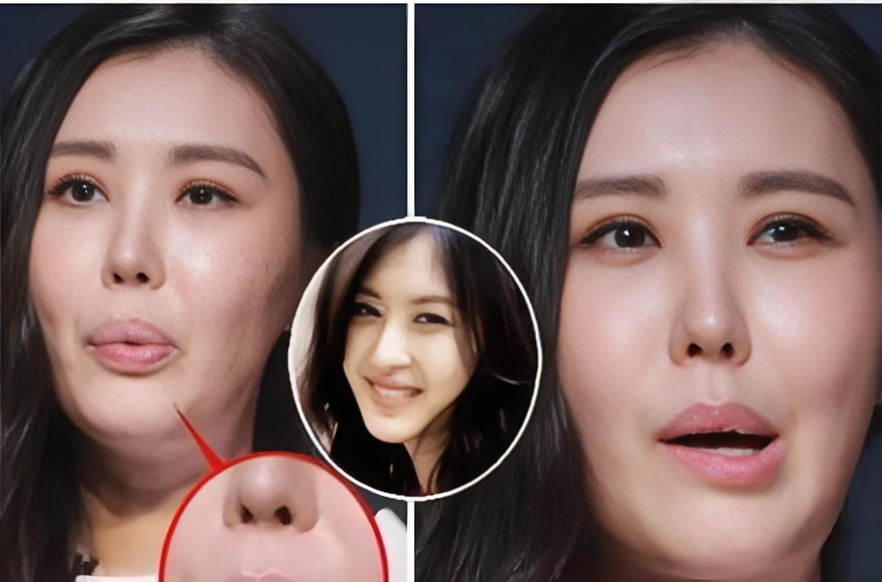 田朴珺鼻子是越整越小，其实整容女一定绝情，在自己脸上动刀，本质上是对自己狠，对自