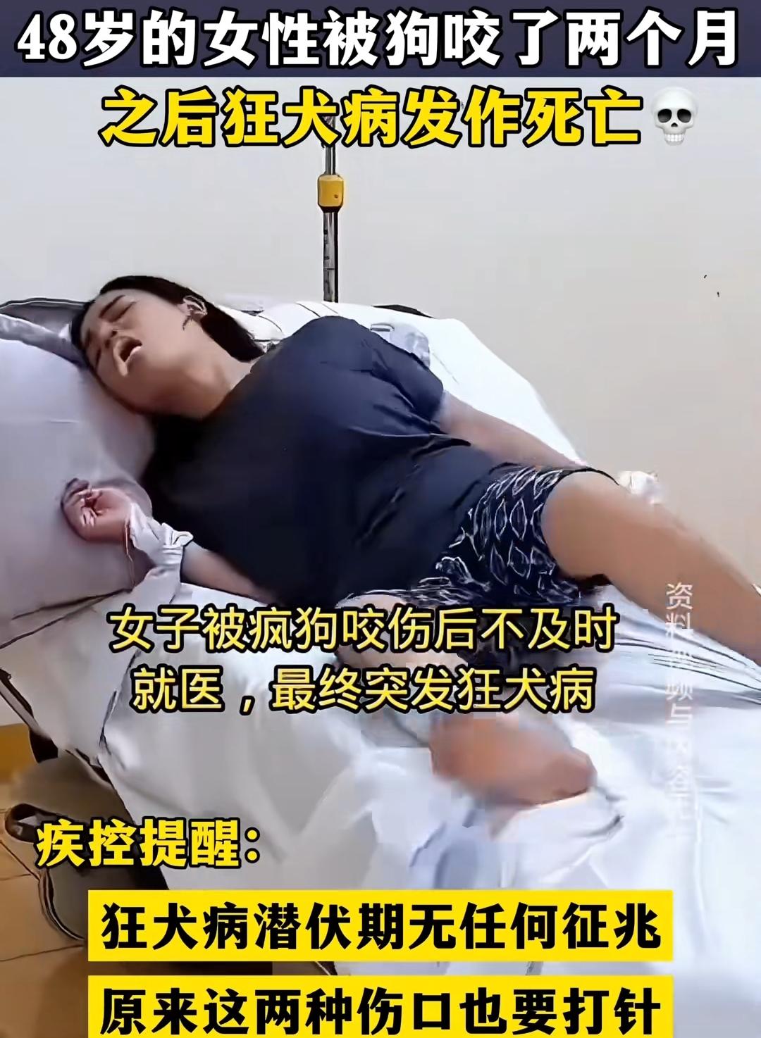 48岁女士被狗咬后狂犬病发作死亡！养猫狗的你，这几点一定要知道一位48岁女