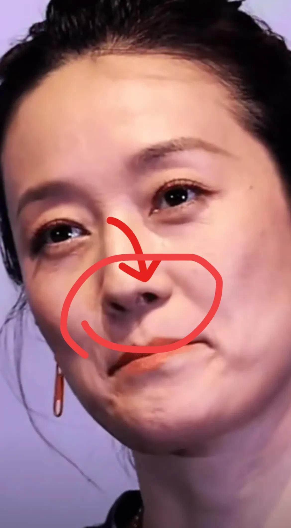 我的天，我没被马伊琍的笑容和谈吐吸引，我被她的鼻子吸引了；这鼻孔处是怎么回事呢