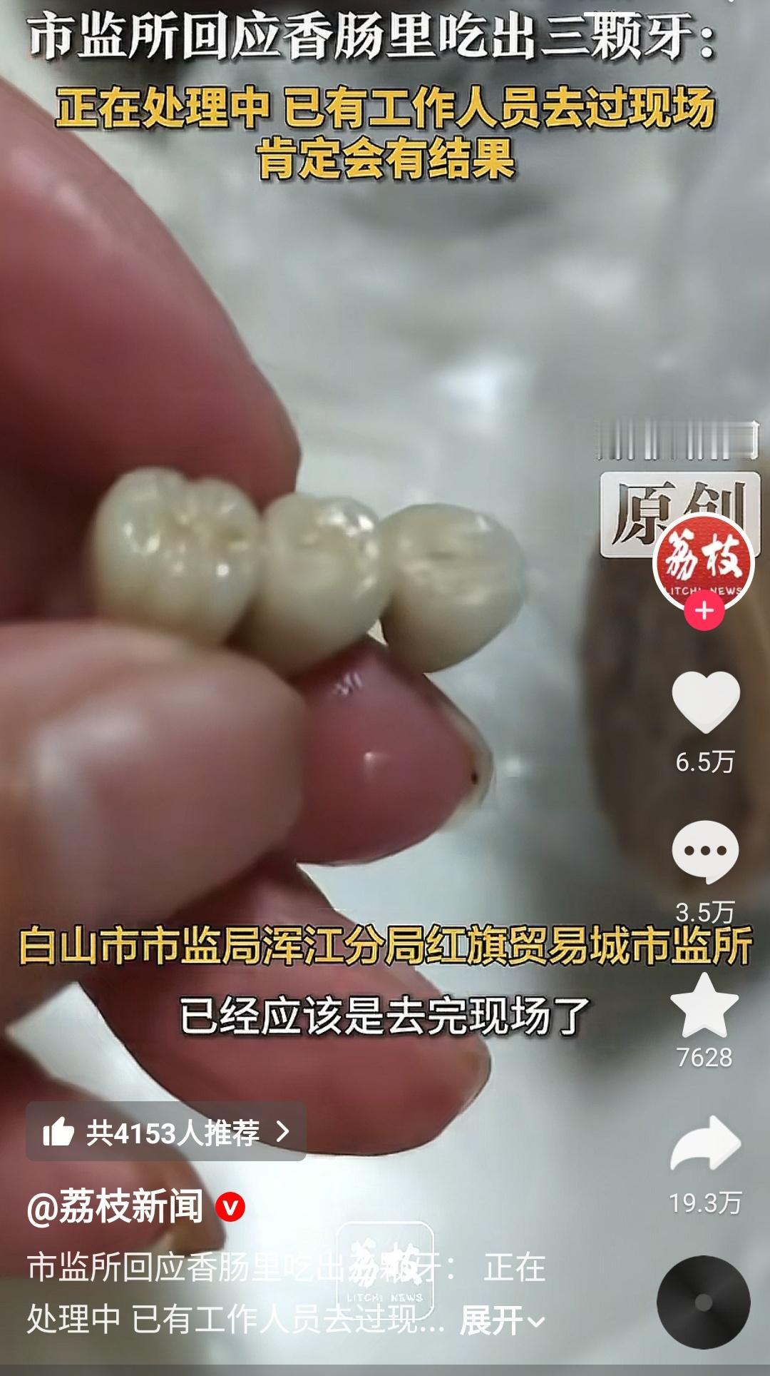 吉林，买烤肠吃出3颗牙冠，摊主是位老太，不认账，经过协调，摊主终于道了歉！这个牙