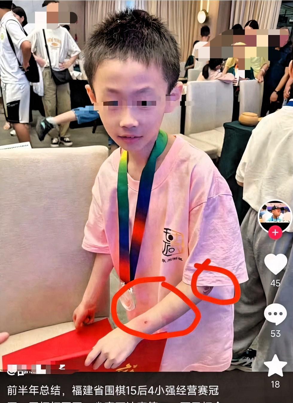 痛心，围棋天才少年朱宏鑫，19号晚上一跃而下，结束了自己稚嫩的生命，为什么这么优