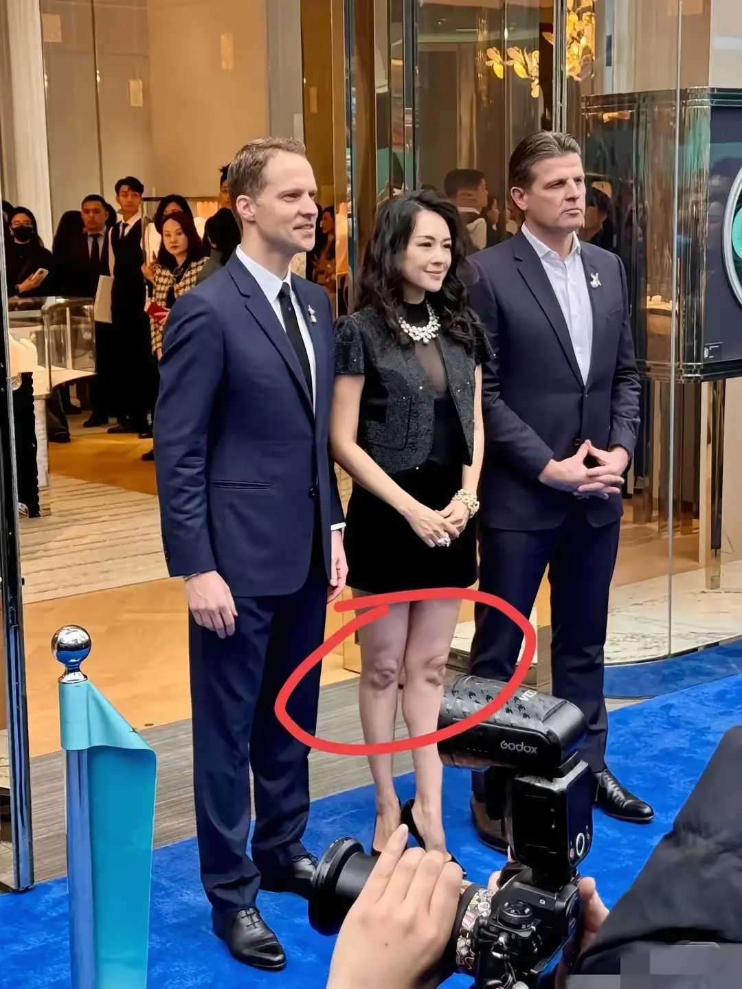为什么膝盖那块总是黑的呢？