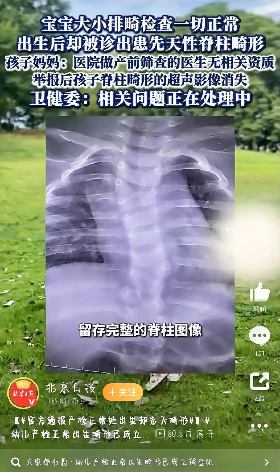 最近湖北黄冈的一个医疗事件让不少家长揪心，产检时说宝宝一切正常，出生后却查出先天