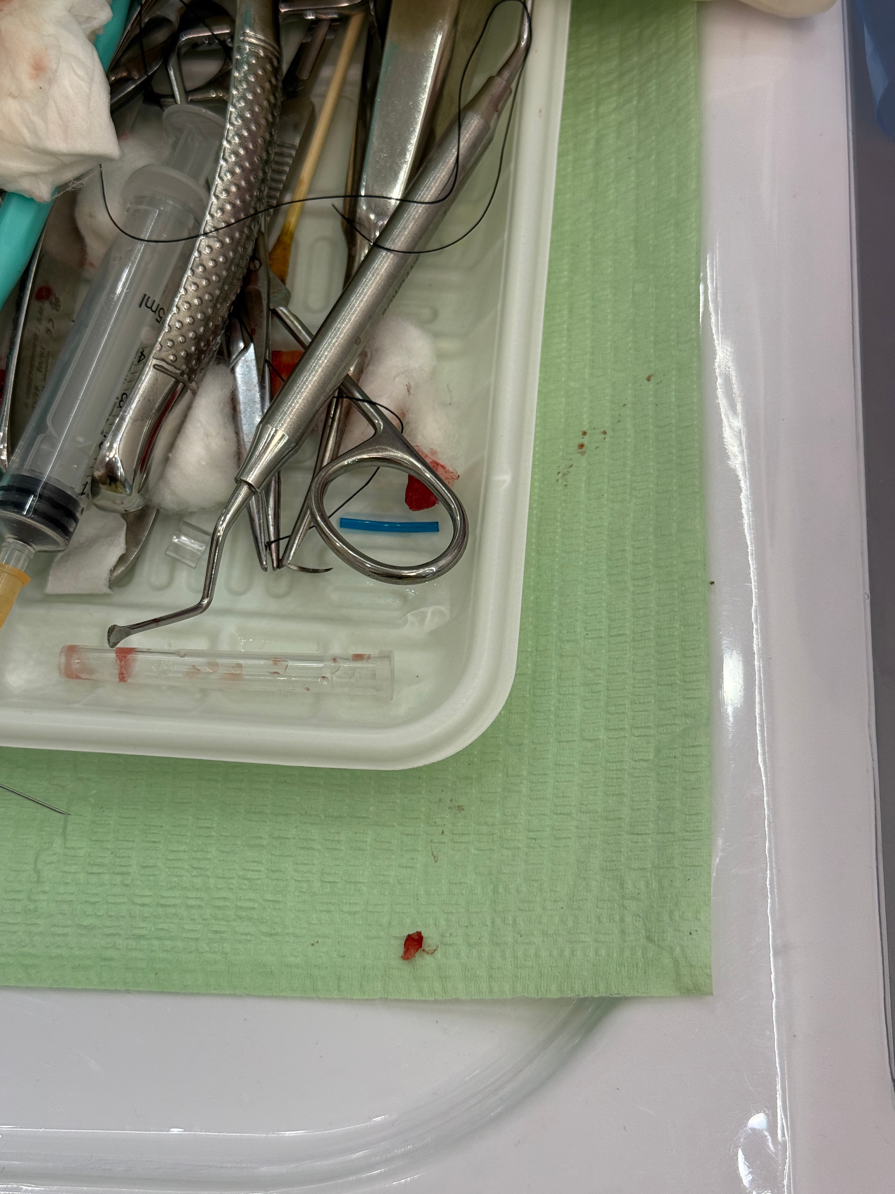 太血腥了…​​​