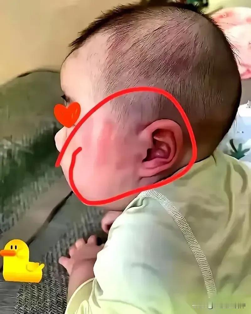 这个婴儿才几个月大，脸上整个一个手指印，他还不会说话，能犯啥错？原来宝爸和宝妈