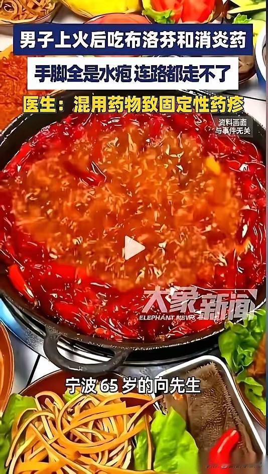 宁波65岁的向先生，就因为牙疼，从家里药箱翻出布洛芬和消炎药，一起吞了下去。牙