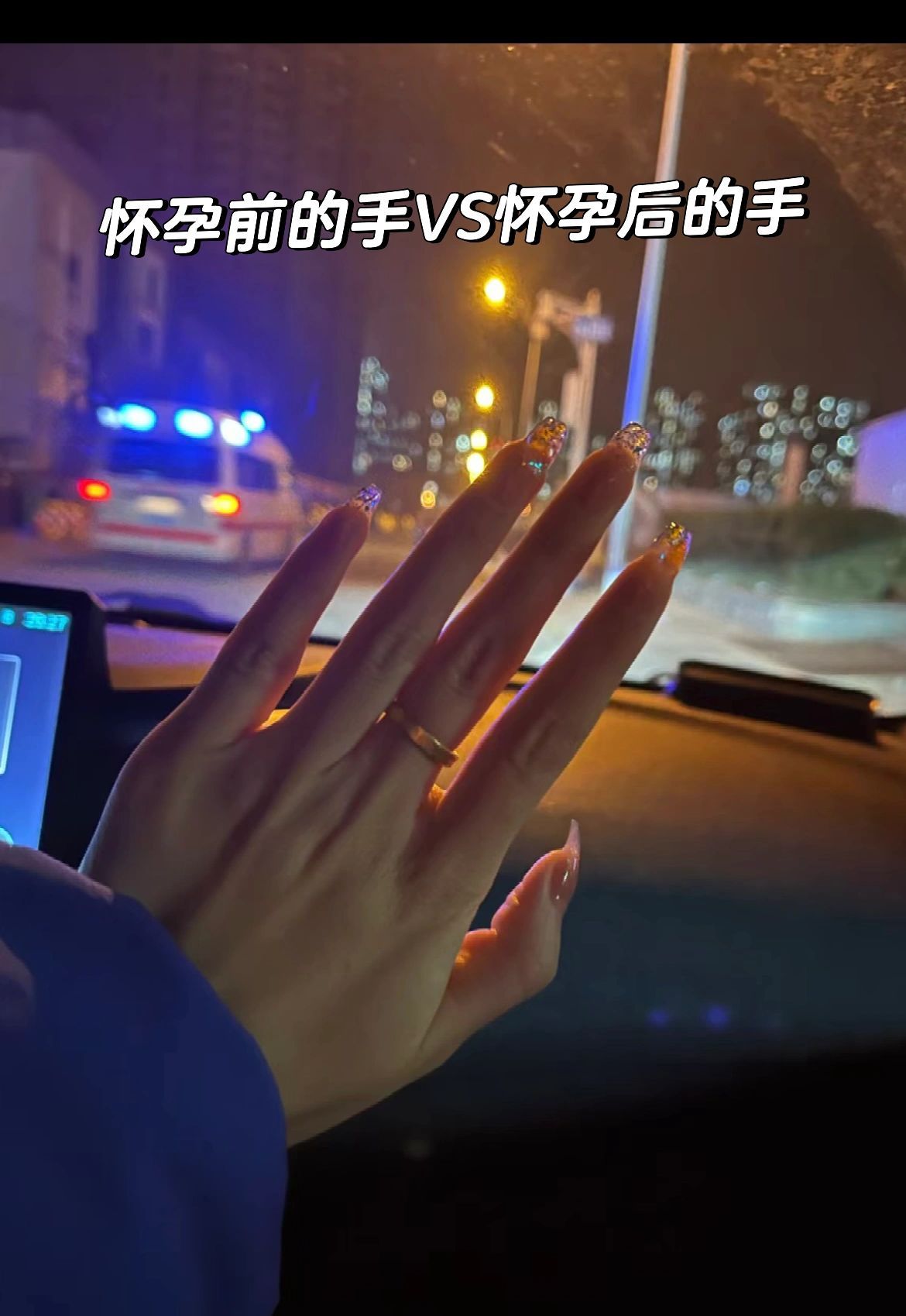 怀孕前的手和怀孕厚的手