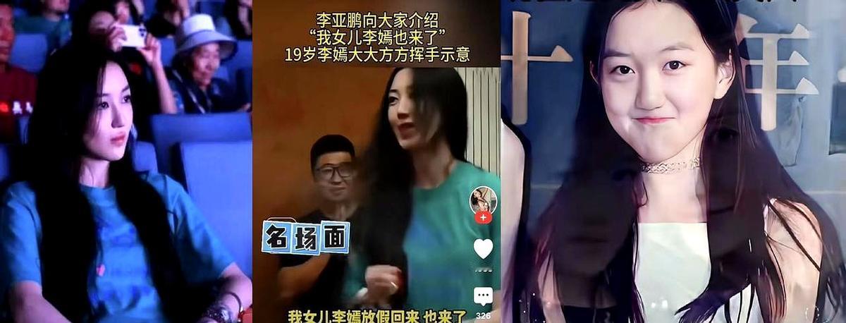 19岁的李嫣，从6个月大起就经历了4次跨国大型修复手术。单次费用在十几年前就超