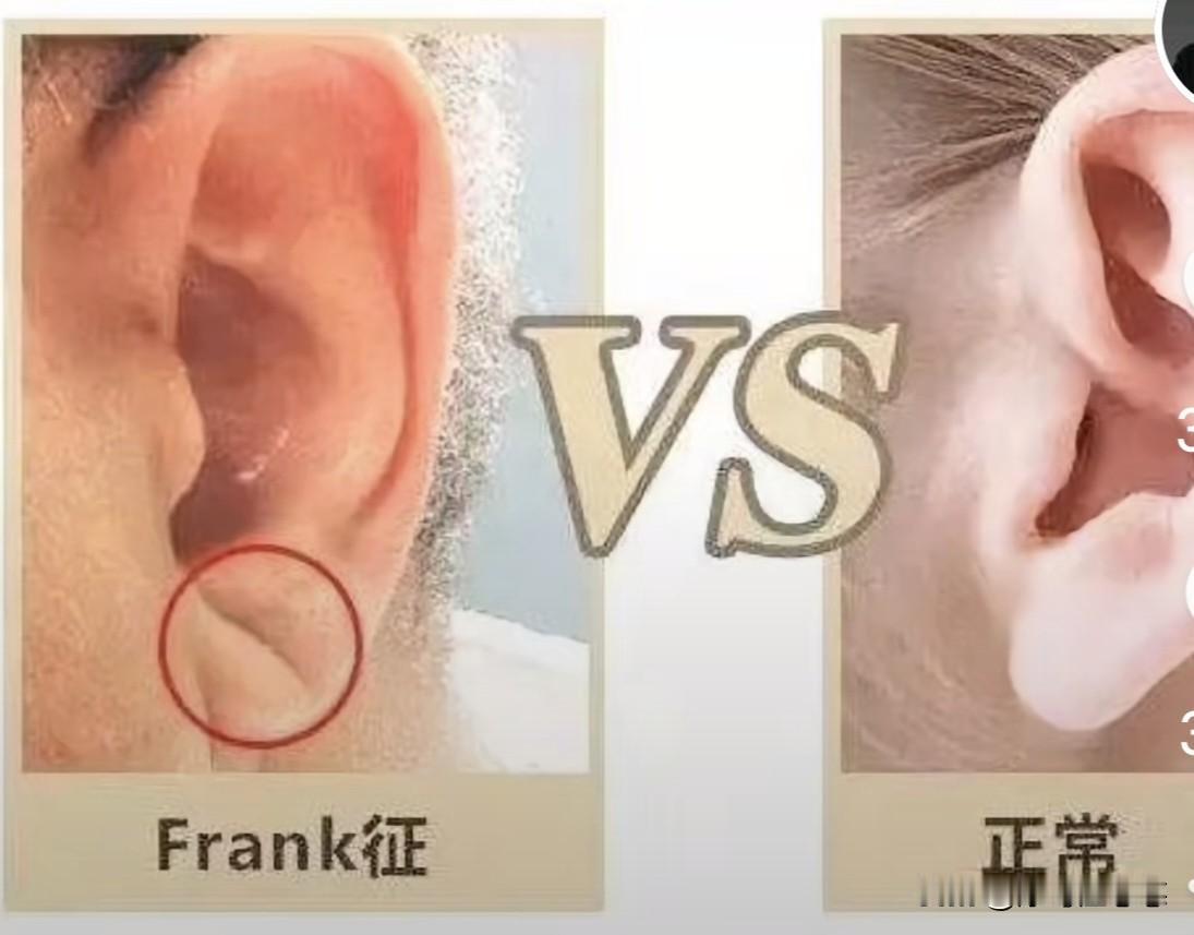 不知道医生是开住院有任务还是病人少了，每次去开检查，医生总是劝住院。