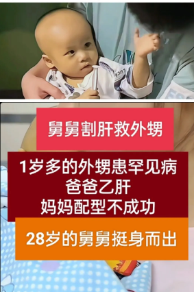 28岁的舅舅割肝救外甥，外甥得了罕见病，他的爸爸有乙肝不能给他割肝，妈妈配型又不