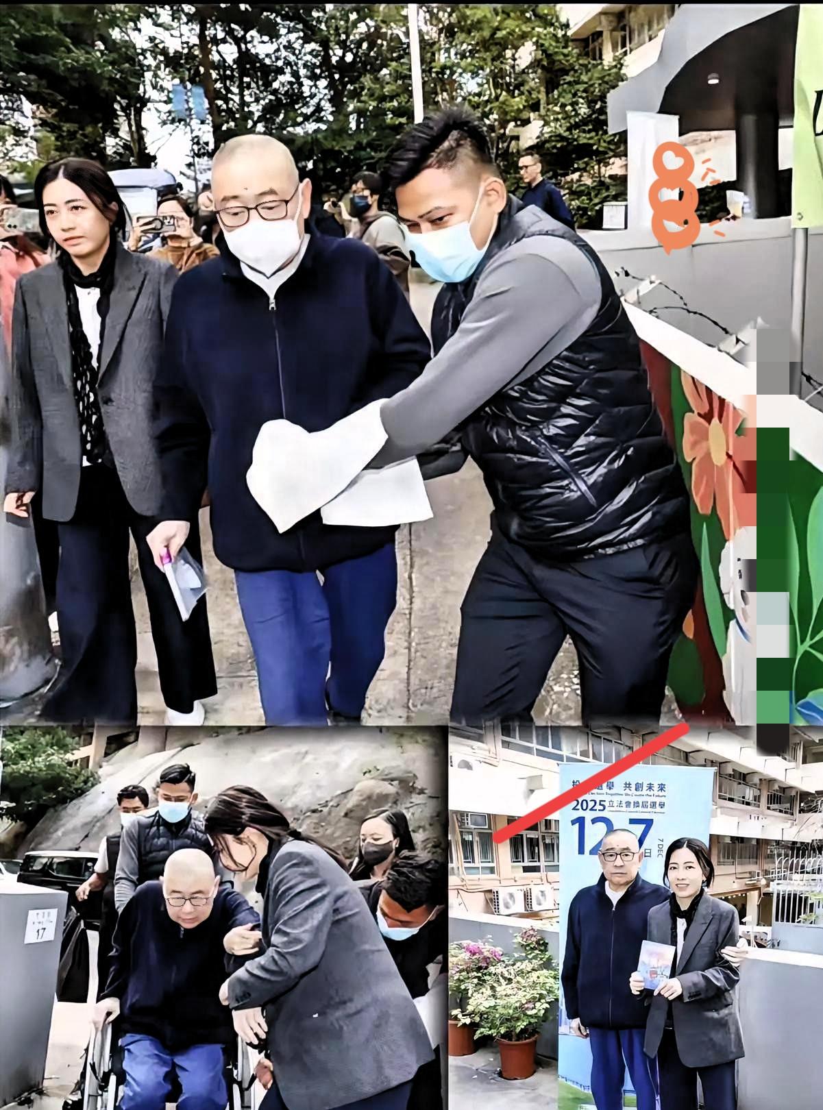 3D打印器官来了！​刘銮雄换肾8年，近几日出现排异反应，高烧40度，尿血严重。