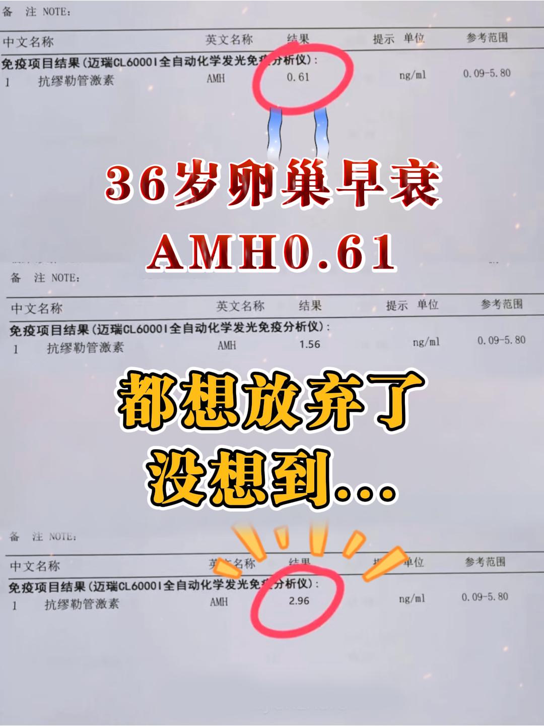 36岁刘女士，因“月经推后、量少色淡3月，伴不孕1年”就诊。  症见...