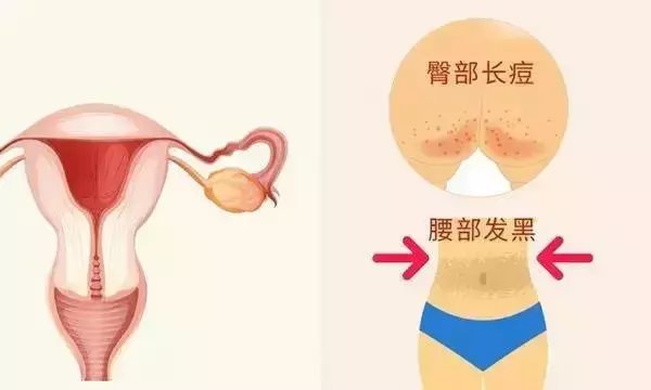 这里发黑, 说明子宫毒素太多