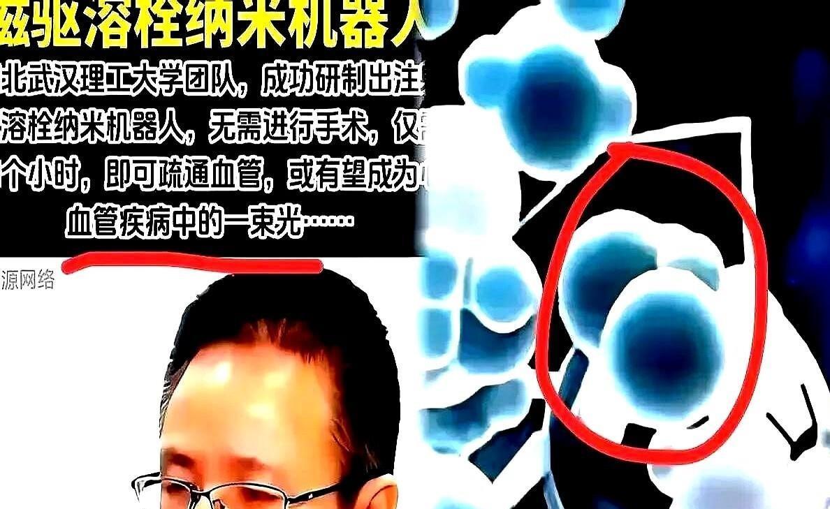 “早上一觉醒来听说武汉理工整了个黑科技！往血管里打一针磁性纳米粒子，外头用磁场一