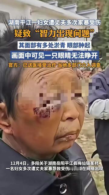 这才是家暴最让人痛心的后果！湖南平江的大姐，被丈夫多次家暴，现在连自己是