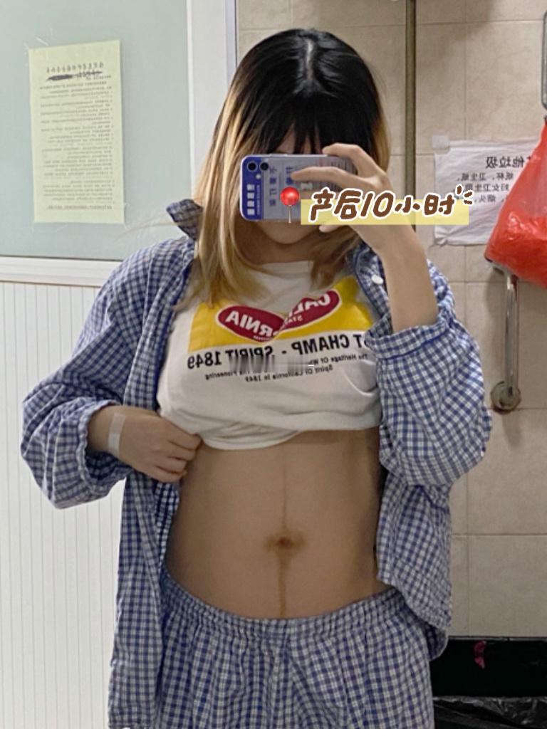 产前96斤有马甲线产后10小时从120斤掉到110斤产后10天掉完水分先瘦腿产