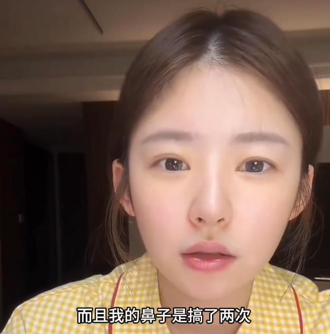 #黄一鸣自曝整容失败#“捞姐”成功上岸的黄一鸣直播自曝整容整鼻子失败了，嘴巴还