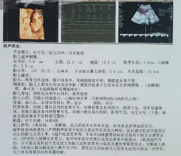 12月17剖腹38周6.6斤男宝宝, 特来还愿, 附带症状+肚型+四维