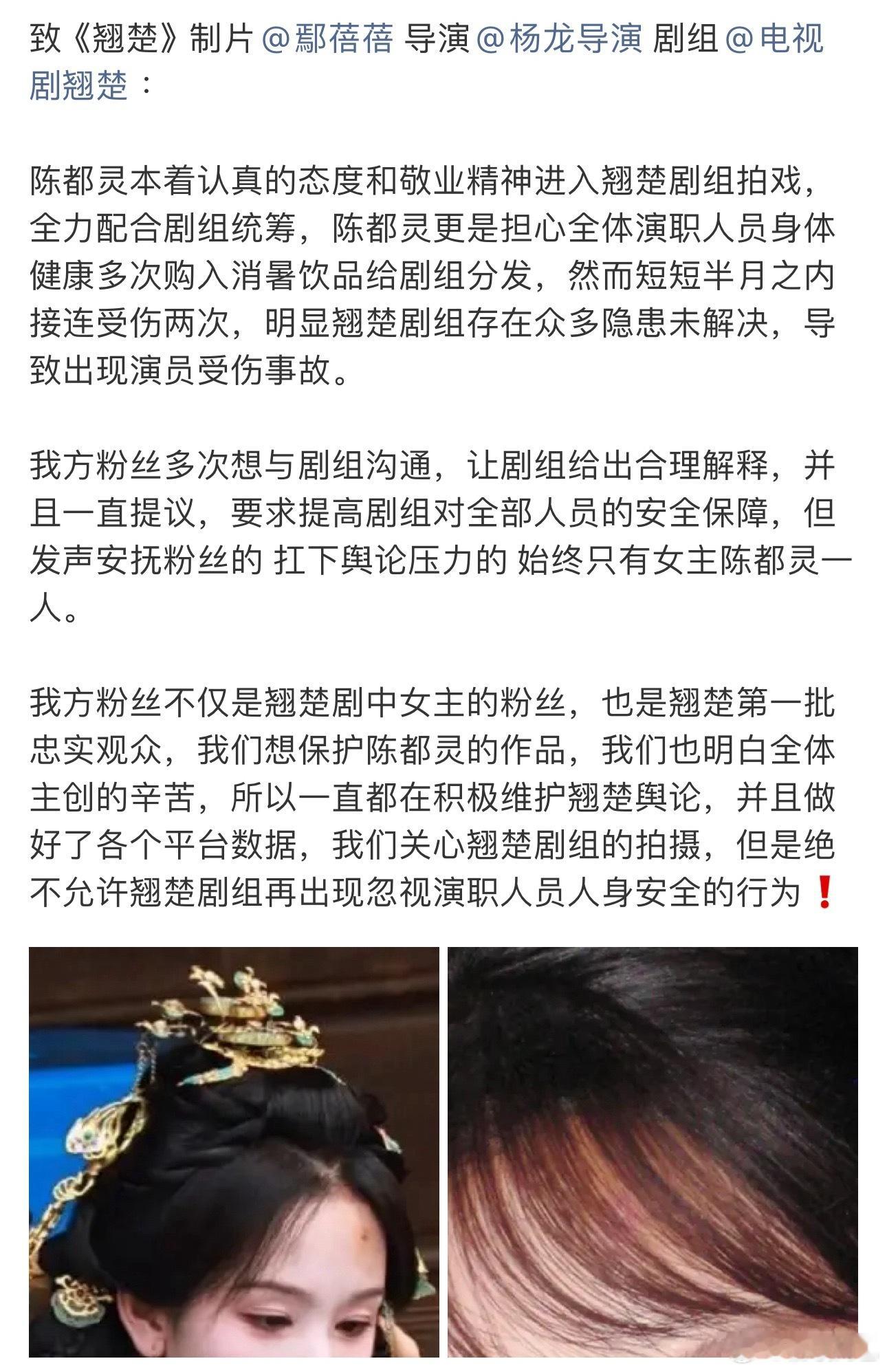 陈都灵额头伤疤看起来好严重​​​