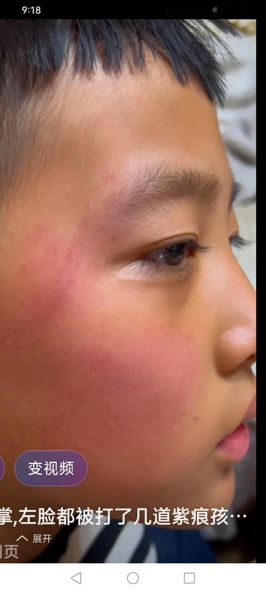 孩子被欺负,四句话让老师主动帮你———第一句:陈述事实,不抱怨老师您好,打