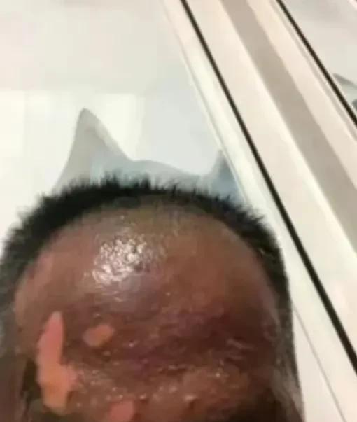 女子烧开水泼丈夫的后续来了！该女子已经给弟弟花费100万，现在又逼丈夫拿钱给弟弟