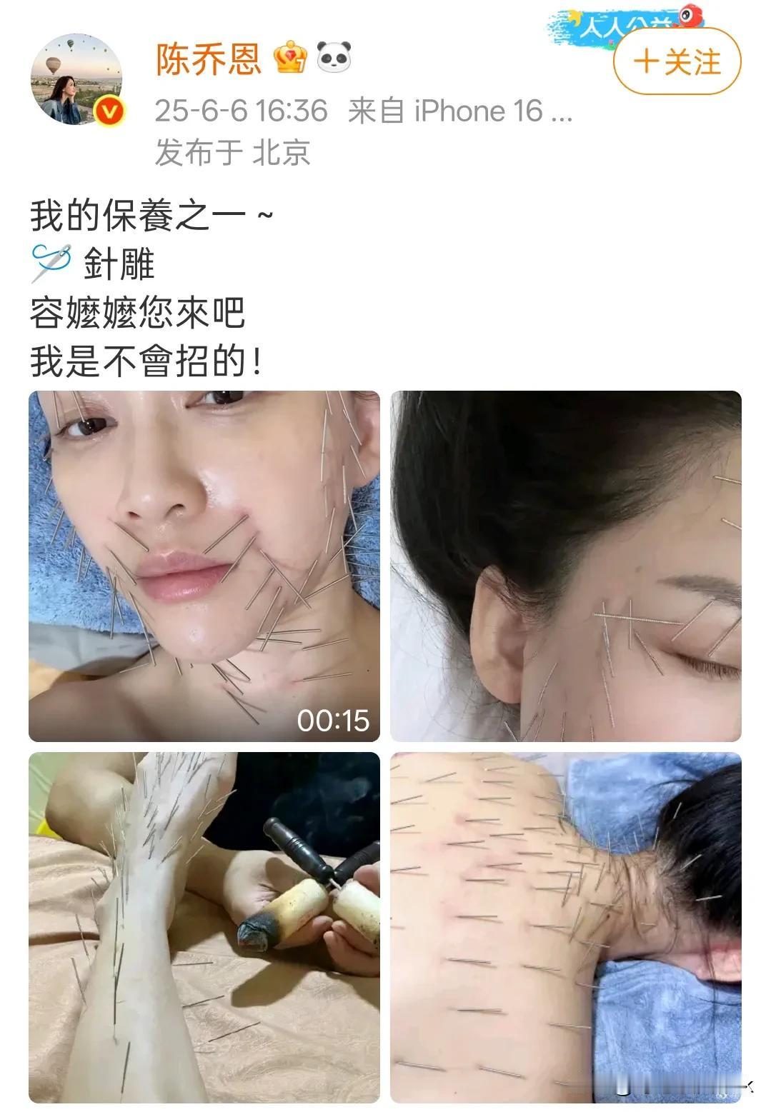 原来陈乔恩保养秘籍是全身针雕，看着都疼[呲牙笑]果然是能演东方不败的女人，扎别