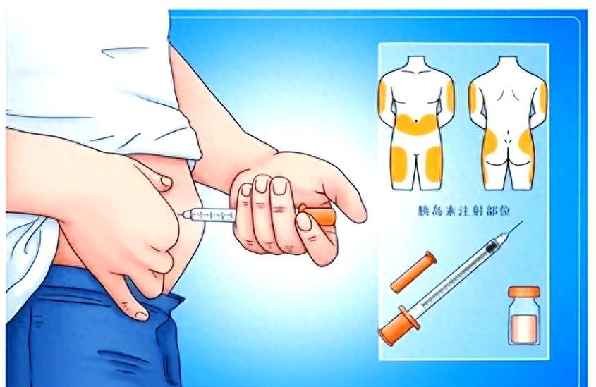 朋友喝酒前先打胰岛素，现在我才明白咋回事我有一个朋友，得了糖尿病。以前看他