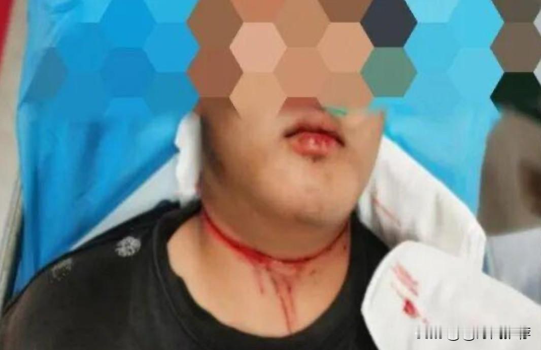 12月17日，有网友发布视频反映，其父亲兰先生于12月10日早上骑三轮车经过洛阳