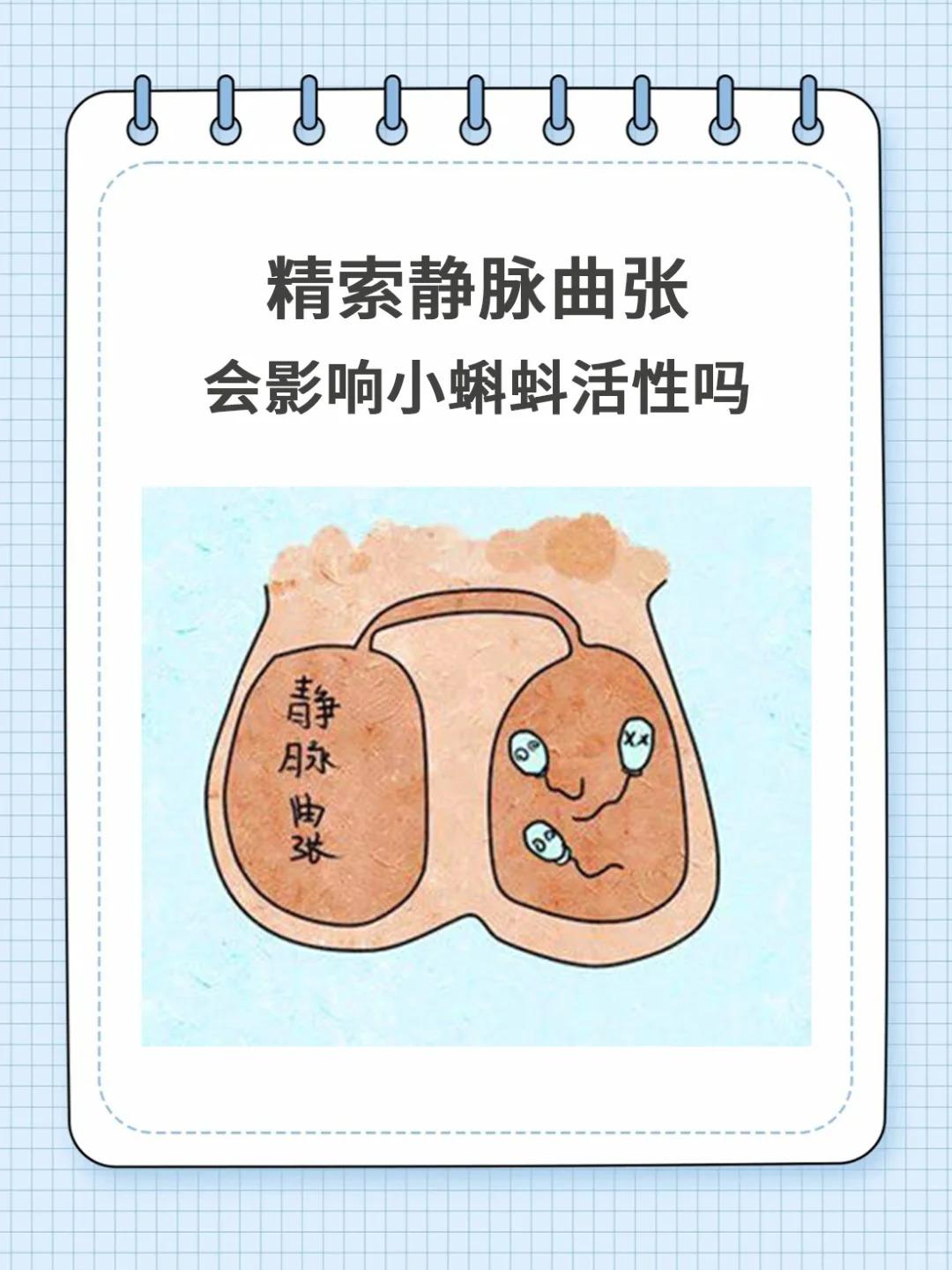 【精索静脉曲张你的