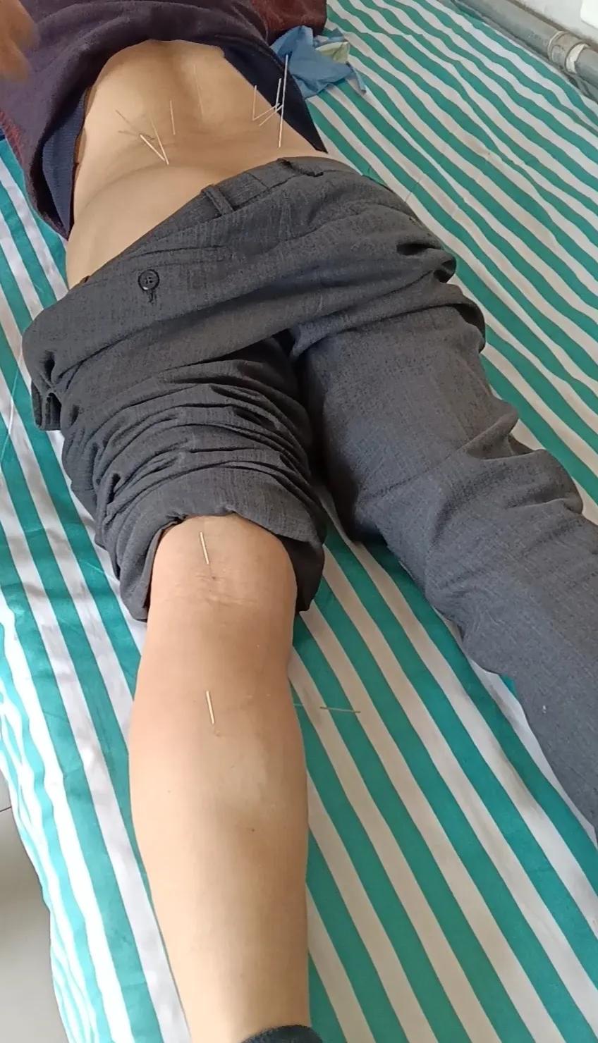 想在村里开诊所挣钱真是太难了，不是取决于医术，而是取决于你是否要面子，今天有个患