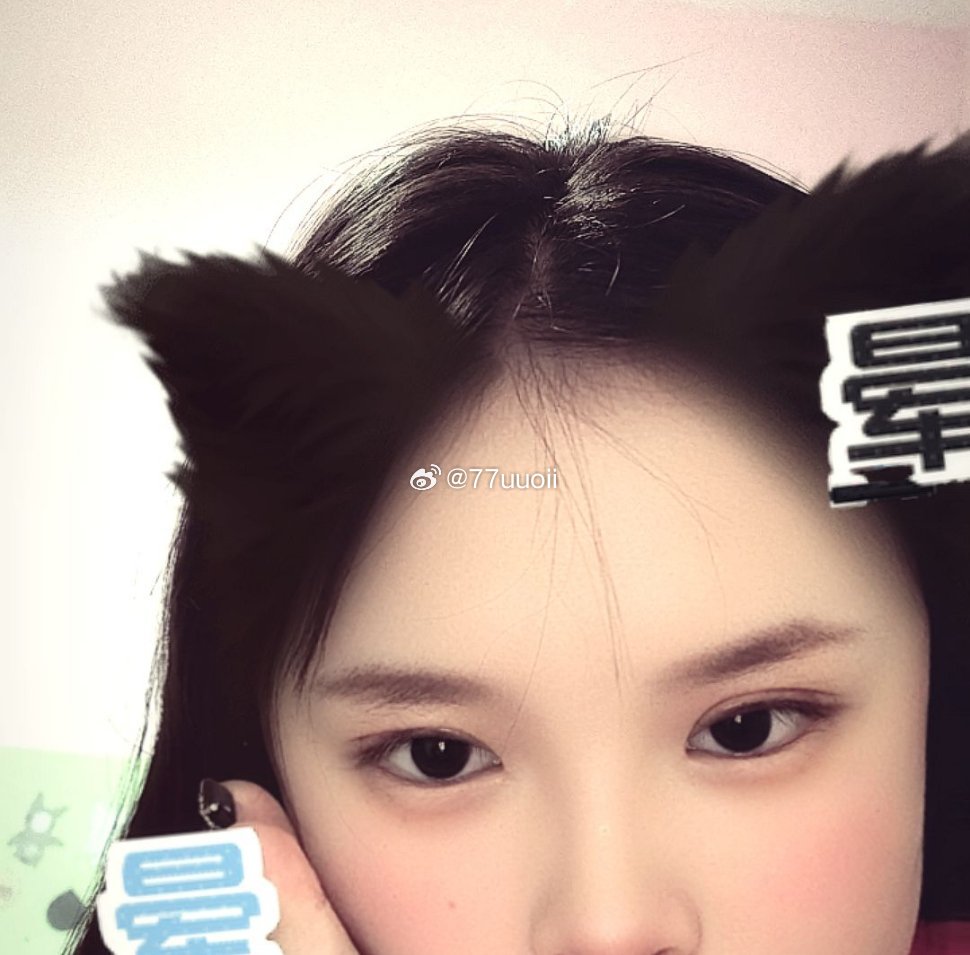 拆完线了回来养vvip