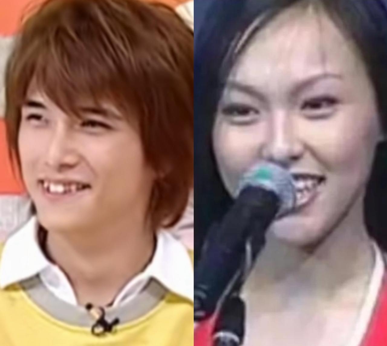 邱泽和唐嫣刚出道时，都曾因牙齿不够整齐被人议论，甚至有过“龅牙”的调侃，后来两人