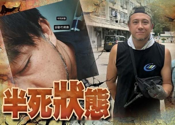 【On.cc】張致恒為頭家五勞七傷　捱病倒下呈半死狀態惹憂心藝人張致恒（Stev