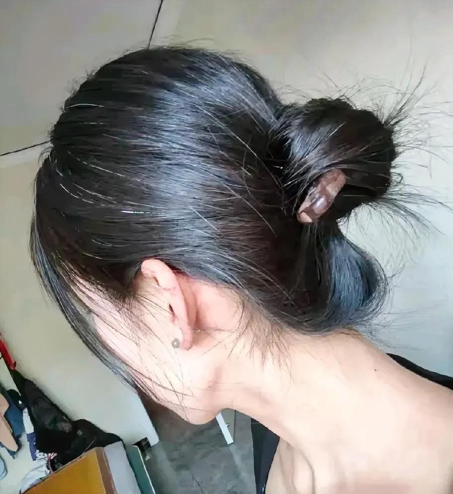 媳妇不止一次说，要不把房子卖了吧，她熬不下去了，头发先是一根根白，现在是一片片！