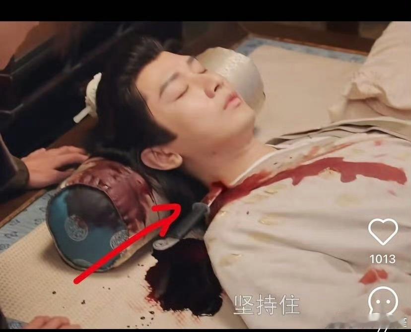刺穿大动脉还能坚持住神了
