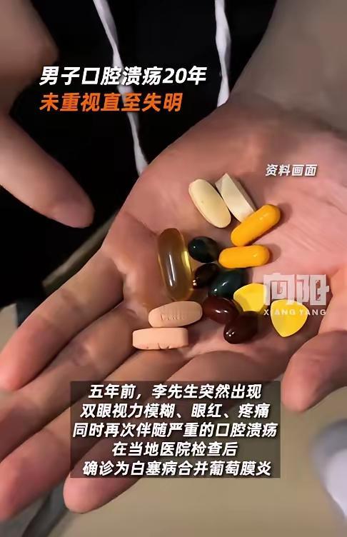 “悲剧还是发生了！”陕西，一男子口腔溃疡反复20年，他以为是上火导致的，所以并未