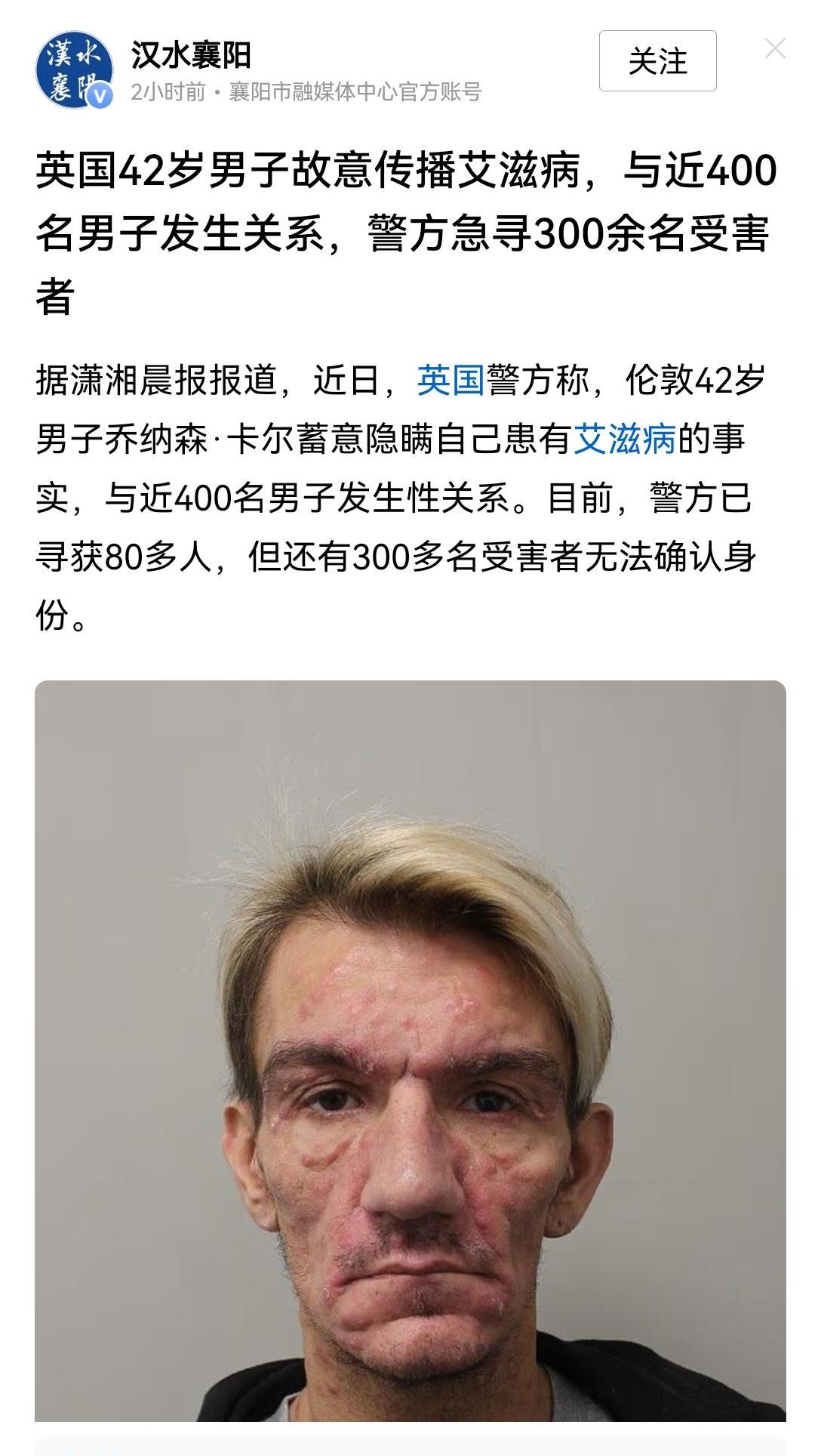 这人，一看就有病[捂眼睛][捂眼睛]，为啥有那么多男的，跟他搞？英国人那么饥渴？