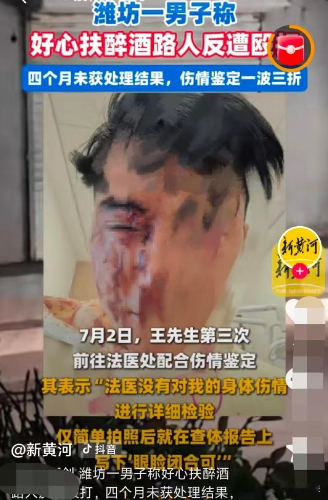 山东潍坊，一男子傍晚开车回家，偶然看见绿化带处躺了2个大汉一动不动，以为对方突发