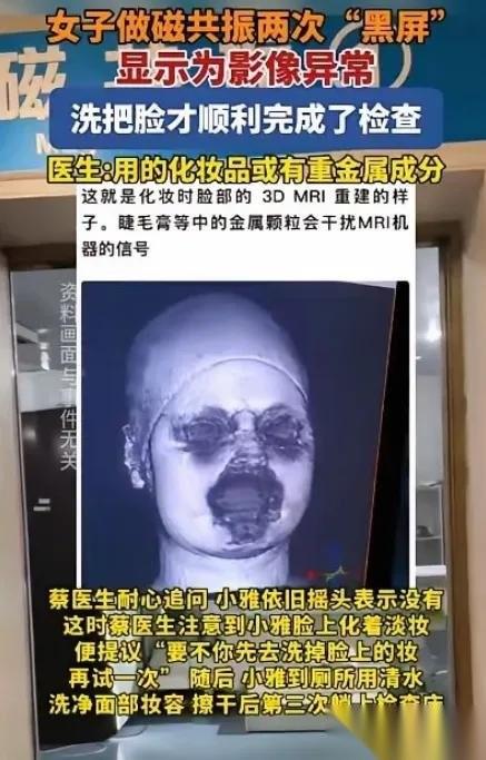 解释不清了！2025年，福建一29岁女生头晕，去医院做头颅磁共振。不料，连续2
