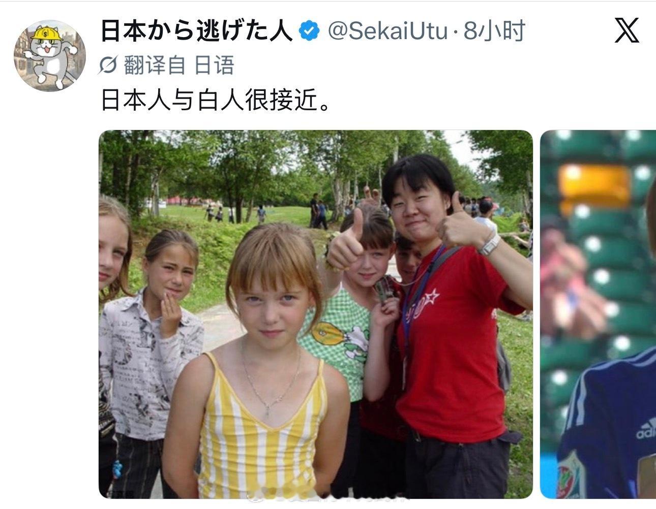 日本人想成为白人想疯了[捂脸哭][捂脸哭][捂脸哭]海外新鲜事热点现场​​​