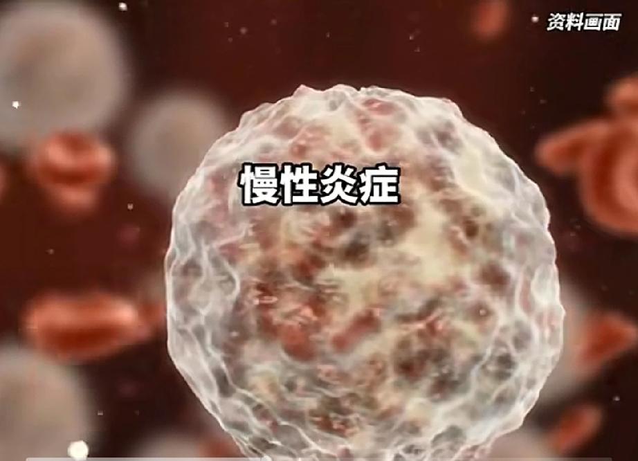 许多人认为自己没有“三高”，心梗便与自己无缘。如果这样认为，那就错了。心梗还有另