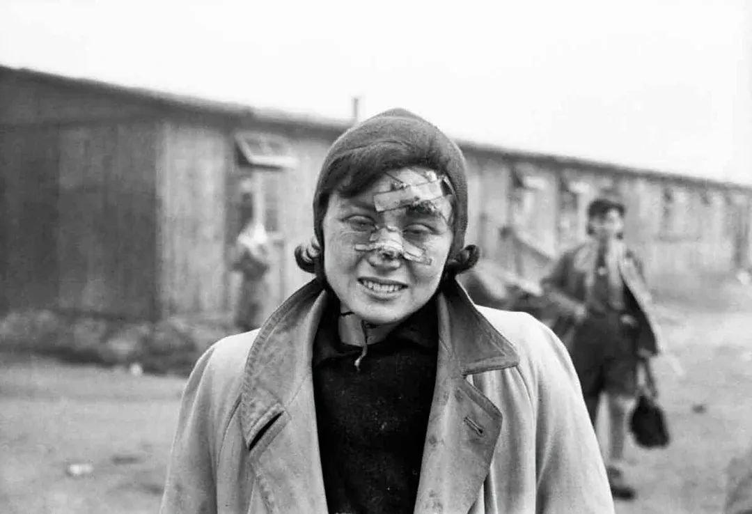 1945年4月17日，英国第11装甲师解放贝尔根-贝尔森集中营两天后，一名女囚犯