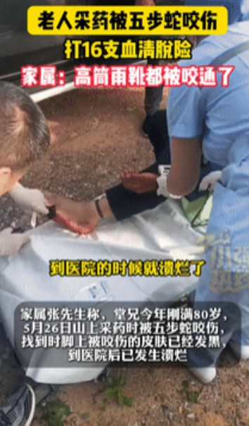 6月5号，媒体报道一80岁老人上山采药，明明穿了高筒雨鞋，却被五步蛇咬穿！120