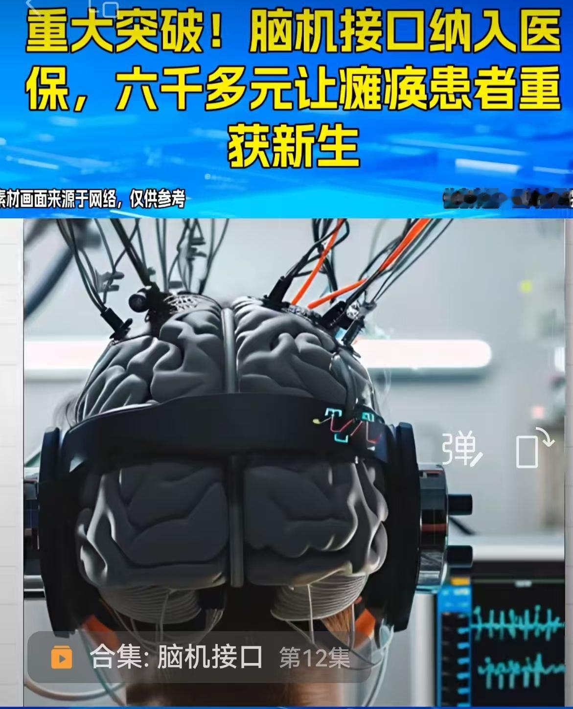 科幻电影里的情节，正在我们的医保账单上变成现实。就在刚刚，四川省医保局传出了一