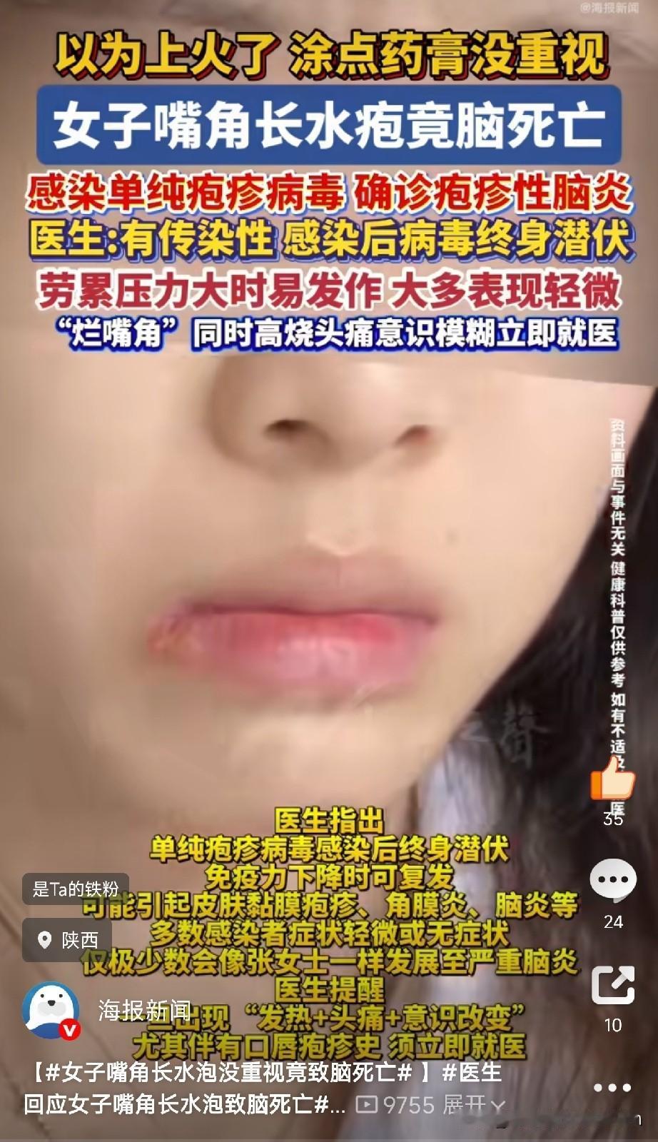 别把小毛病不当事陕西一位30多岁的张女士，自己开着餐馆，起早贪黑忙里忙外，累