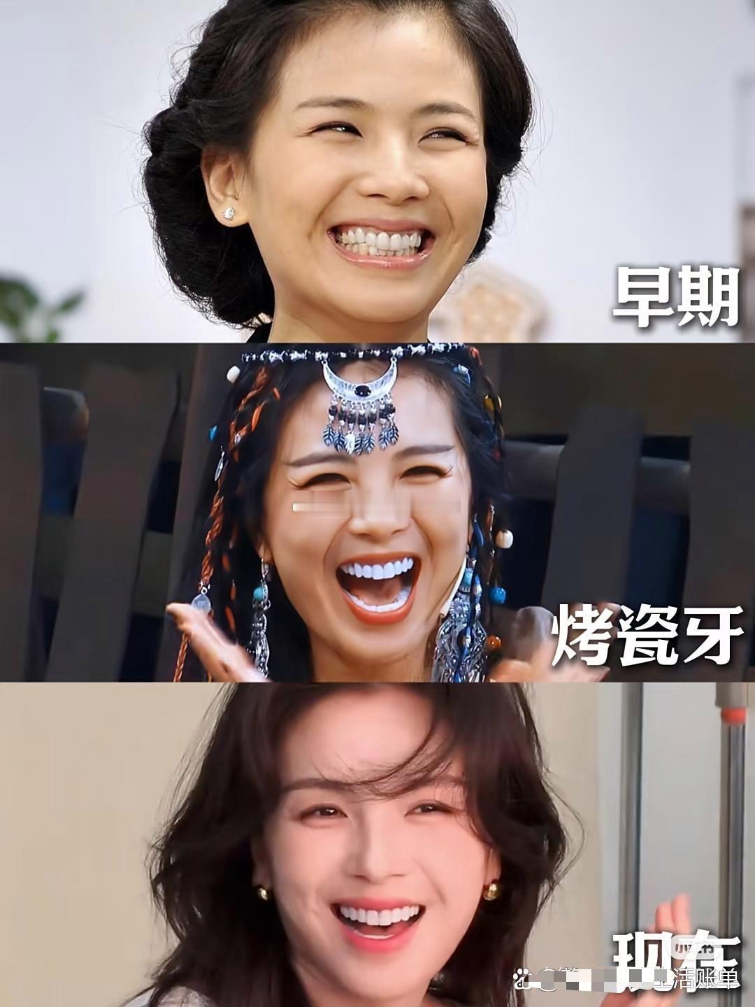 据说刘涛这一口牙花了三百万，到底值不值？​​​