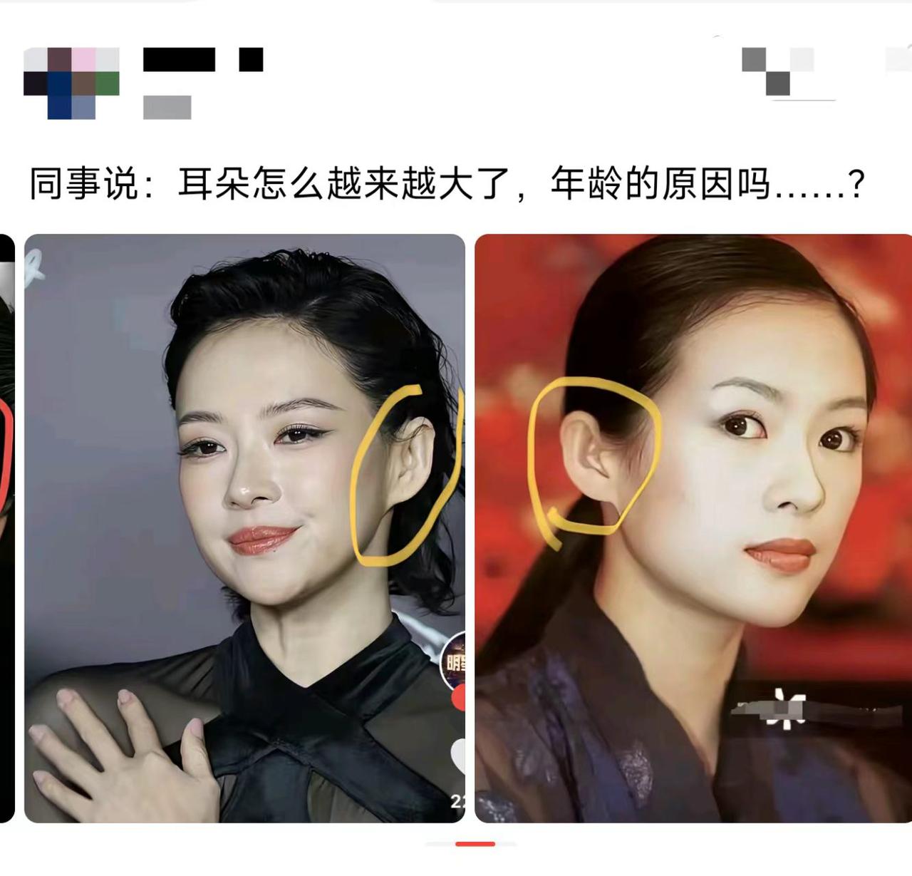难道人老了，软骨真的会一直生长吗？